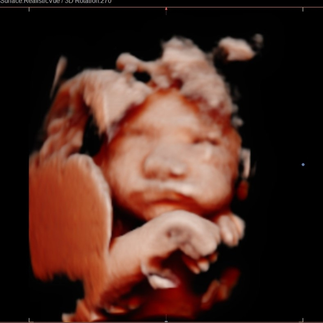 Photo shared by Benny for their Babylist baby registry.