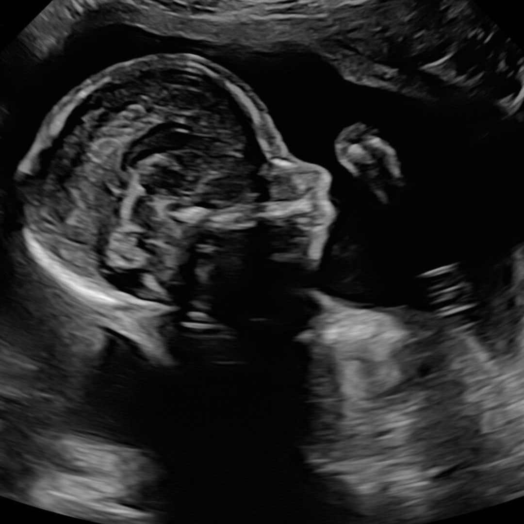 Photo shared by Abby for their Babylist baby registry.