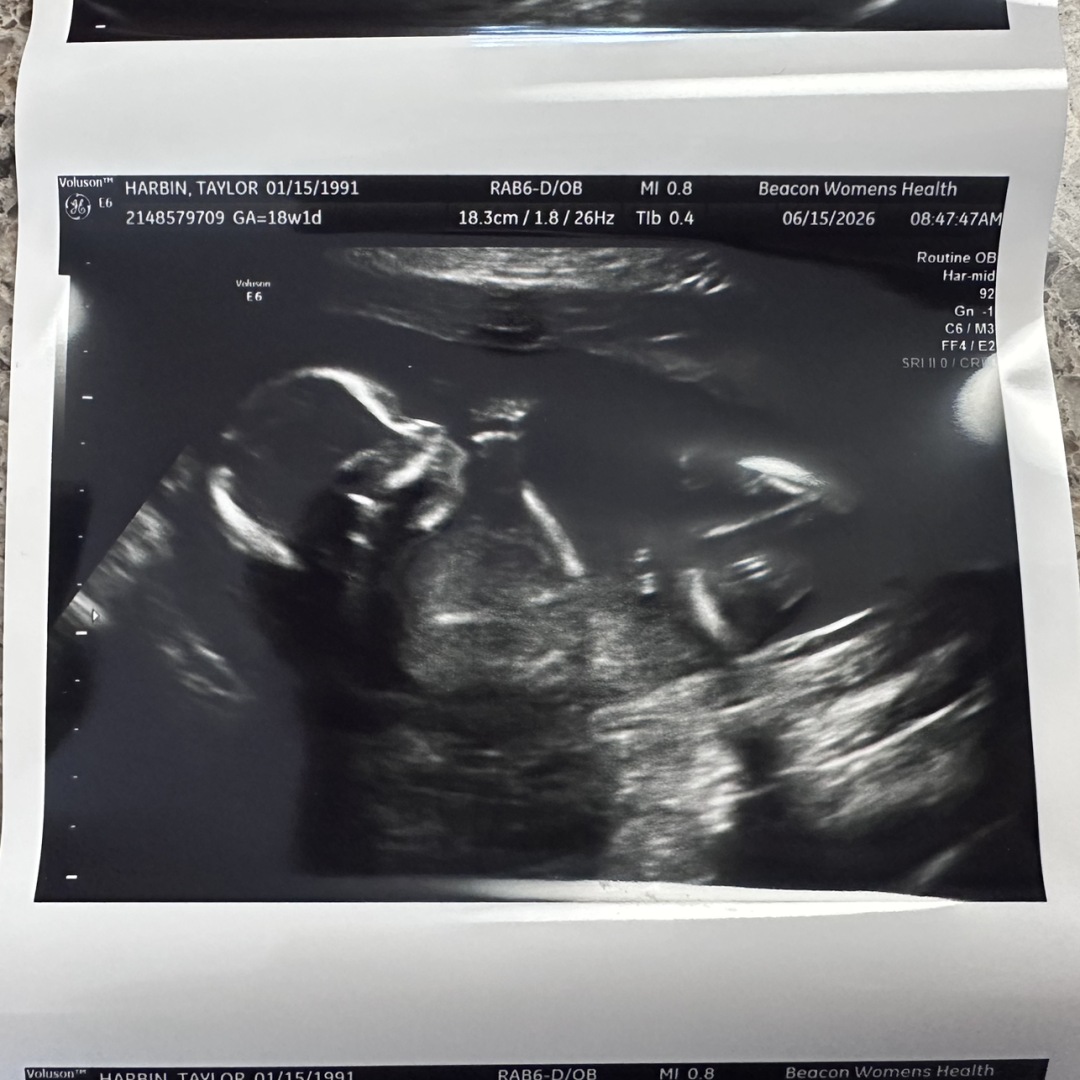 Photo shared by Taylor for their Babylist baby registry.