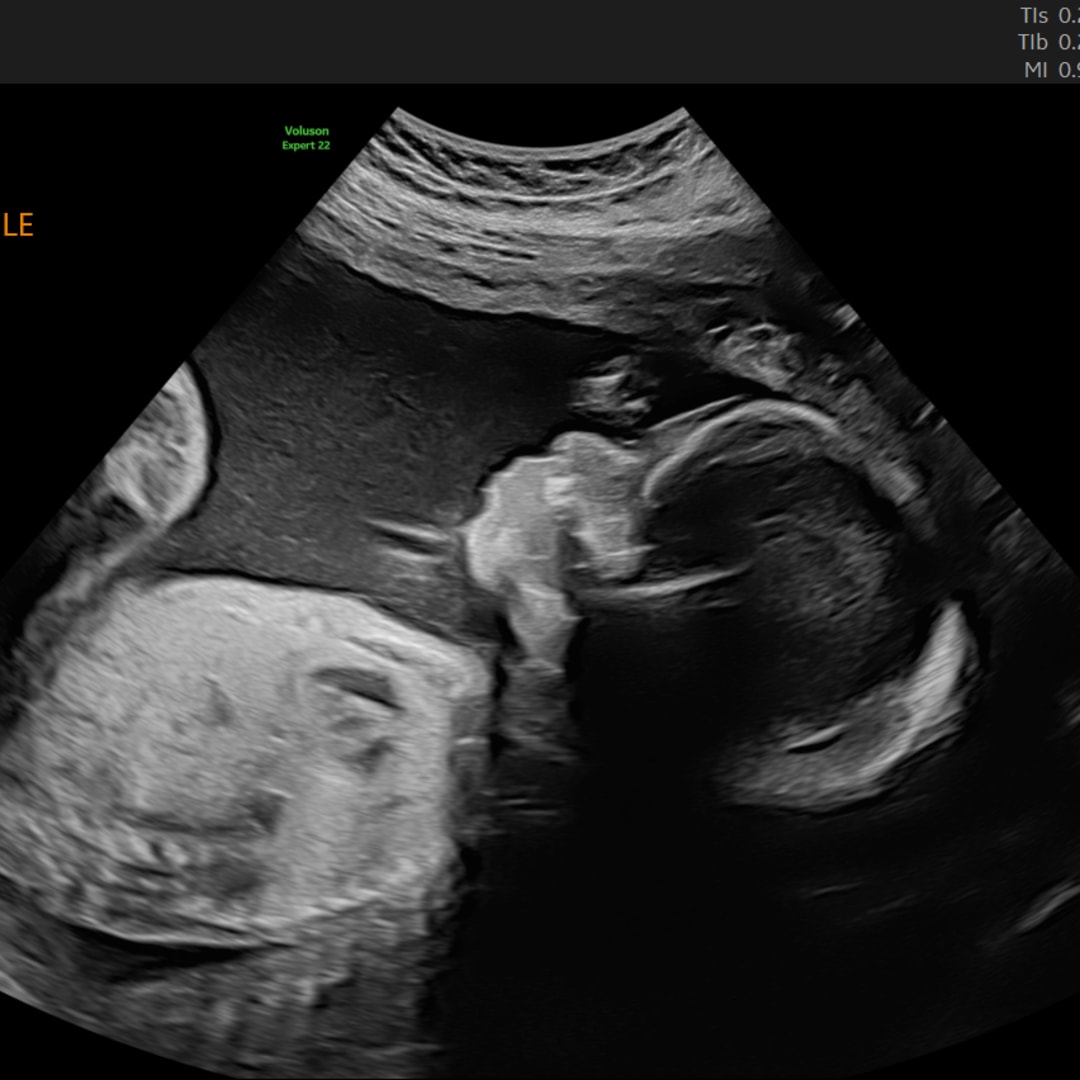 Photo shared by Najah for their Babylist baby registry.
