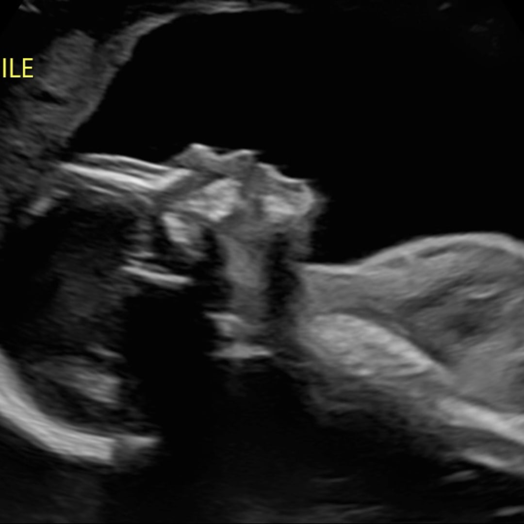 Photo shared by Hamdi for their Babylist baby registry.