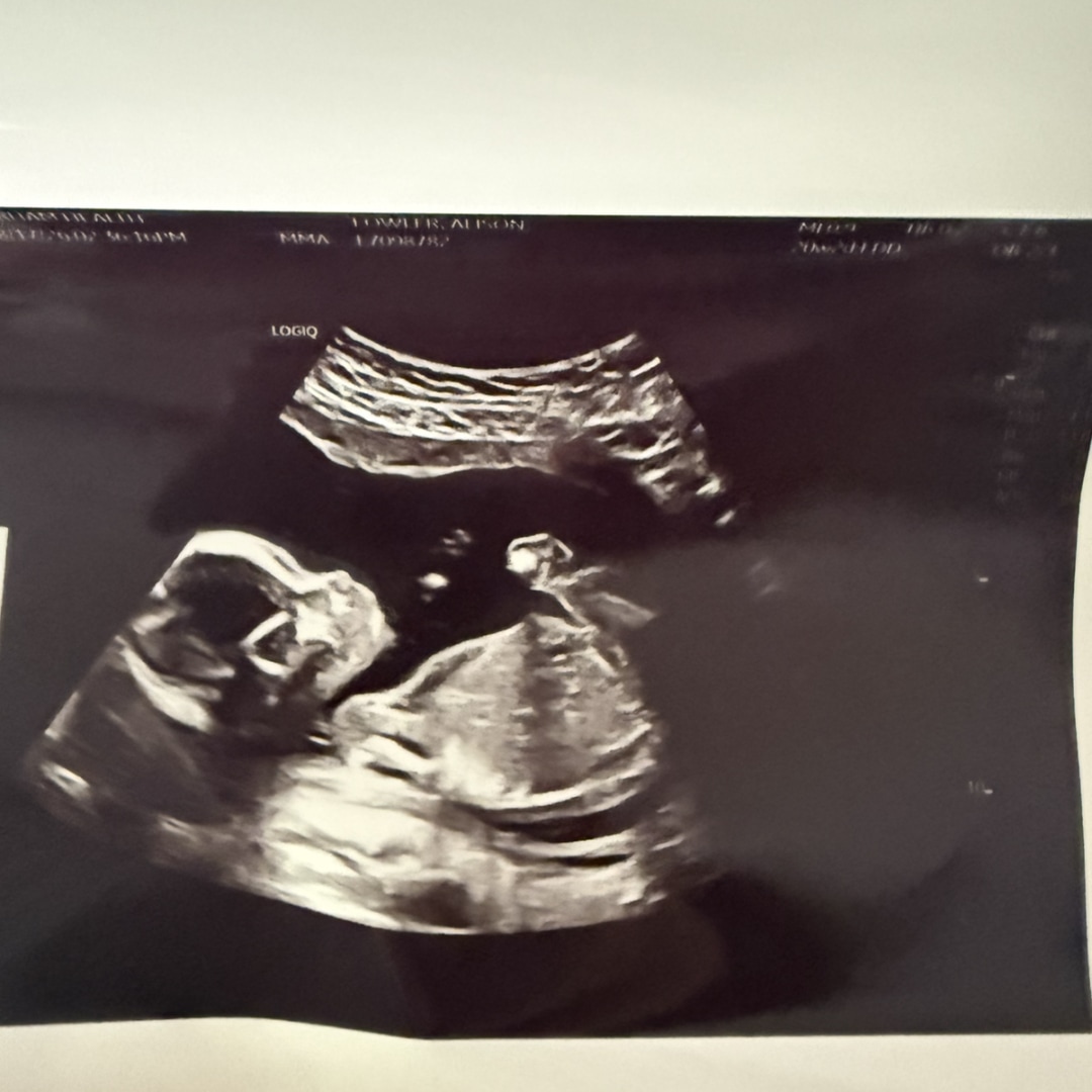 Photo shared by Alison for their Babylist baby registry.