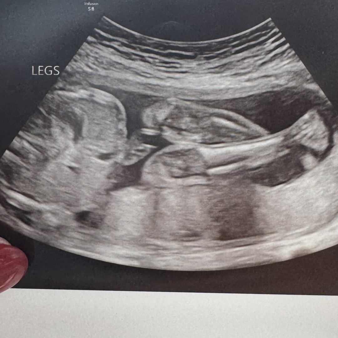 Photo shared by Addison for their Babylist baby registry.