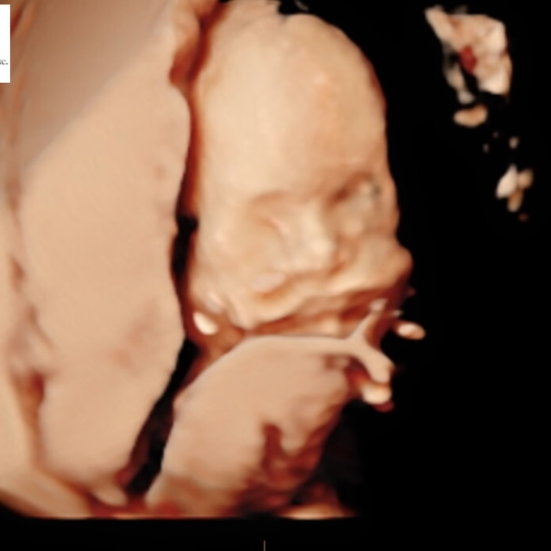 Photo shared by Denise for their Babylist baby registry.