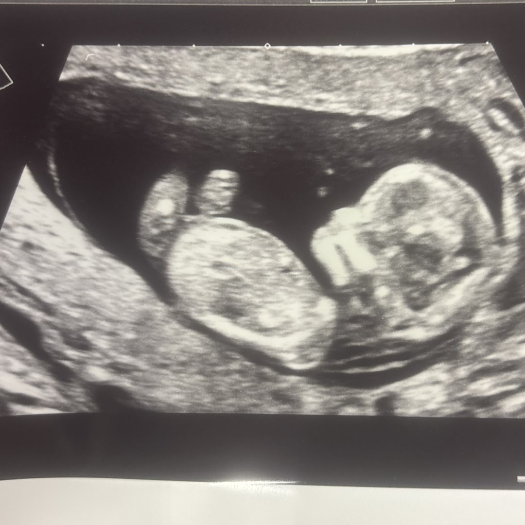 Photo shared by Dasia for their Babylist baby registry.