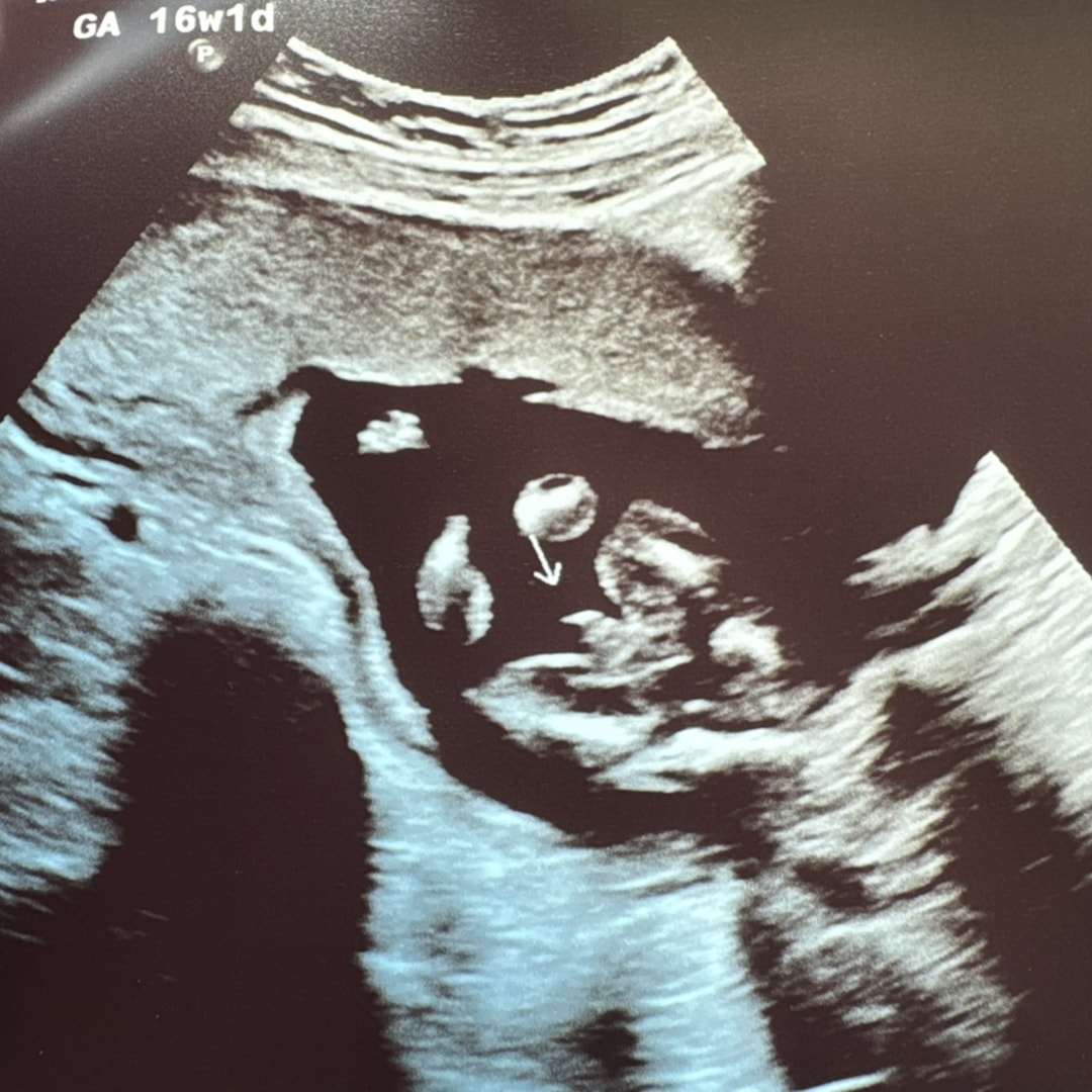 Photo shared by Rylee for their Babylist baby registry.