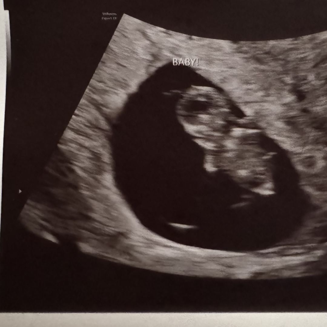 Photo shared by Annabel for their Babylist baby registry.