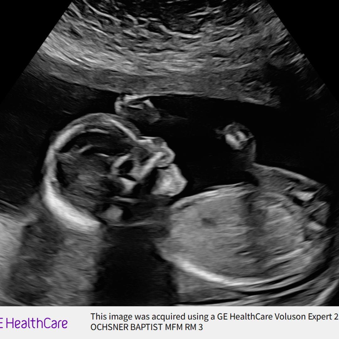 Photo shared by Ali for their Babylist baby registry.