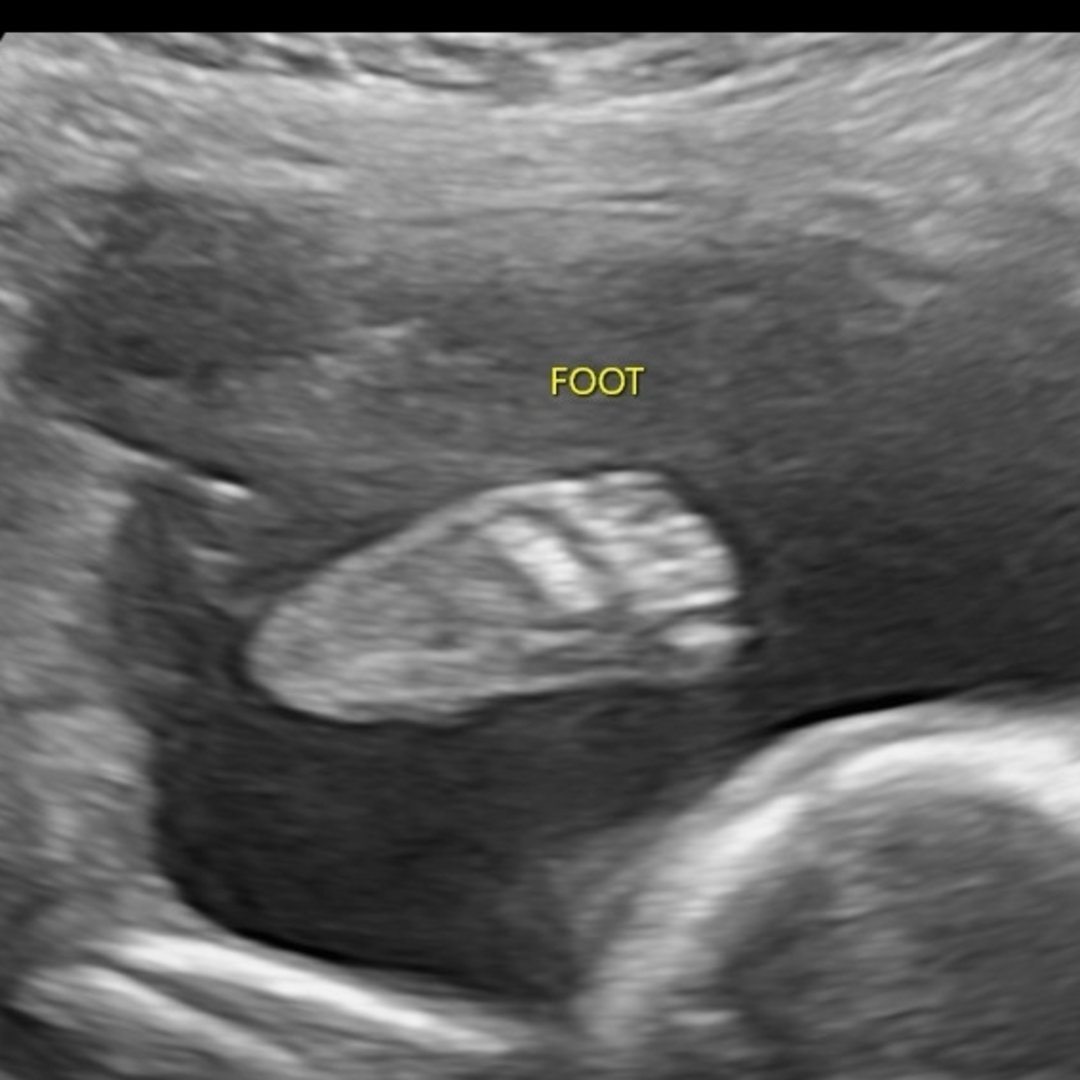 Photo shared by Ellie for their Babylist baby registry.