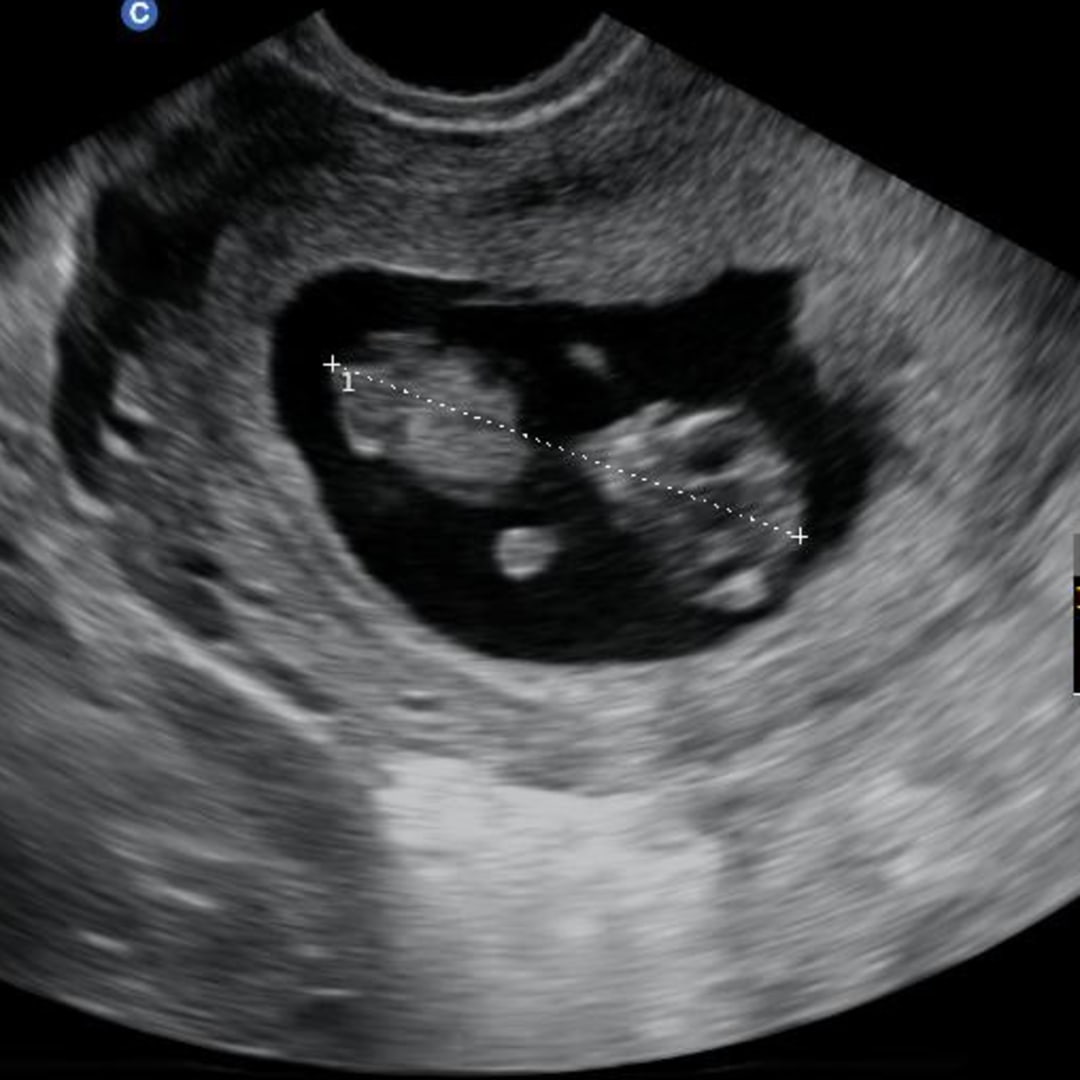 Photo shared by Toria for their Babylist baby registry.