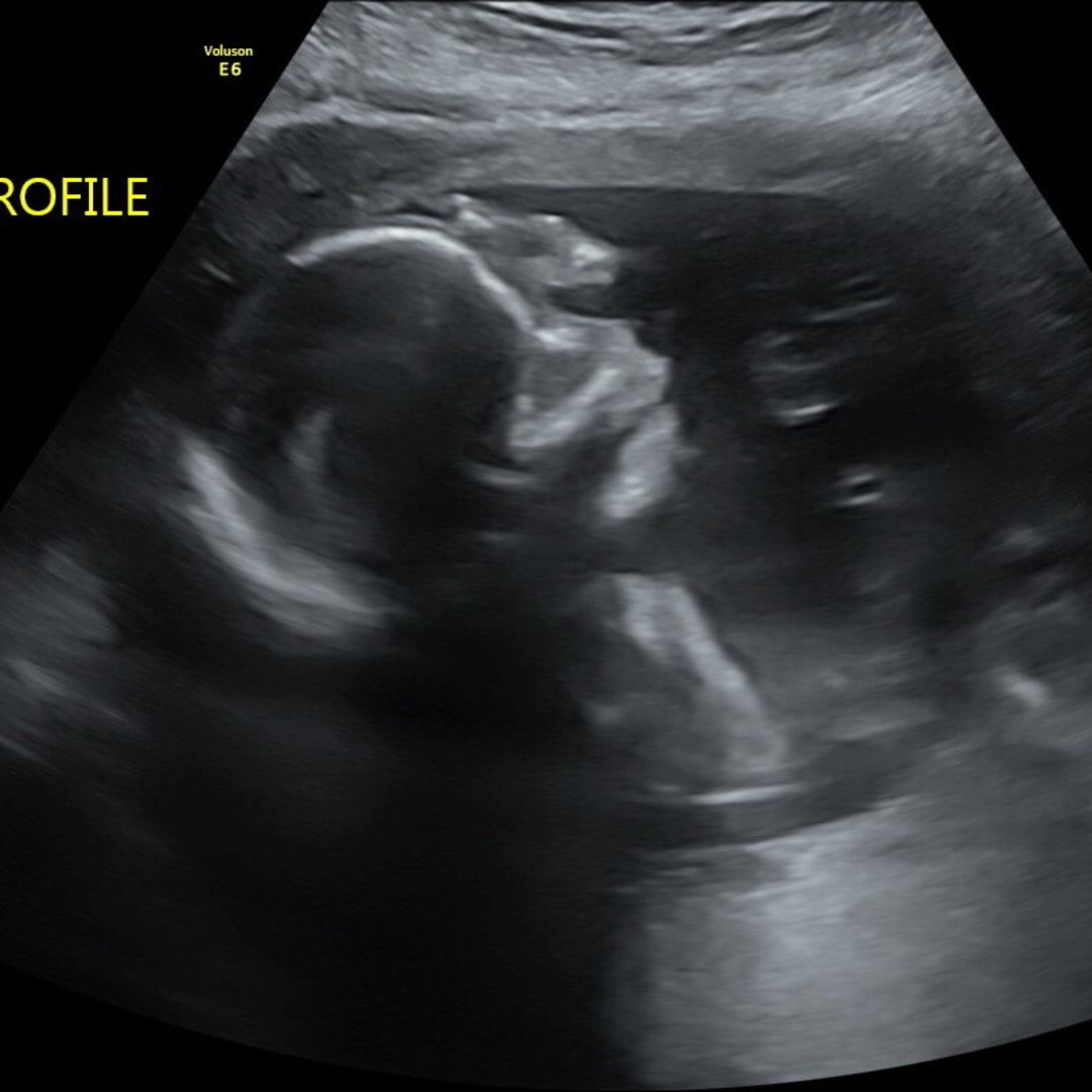 Photo shared by Katelyn for their Babylist baby registry.