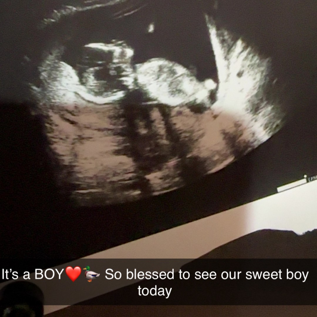 Photo shared by Hailey for their Babylist baby registry.