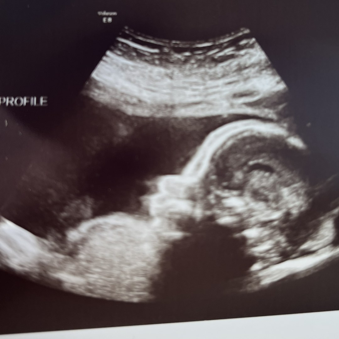 Photo shared by Annie for their Babylist baby registry.