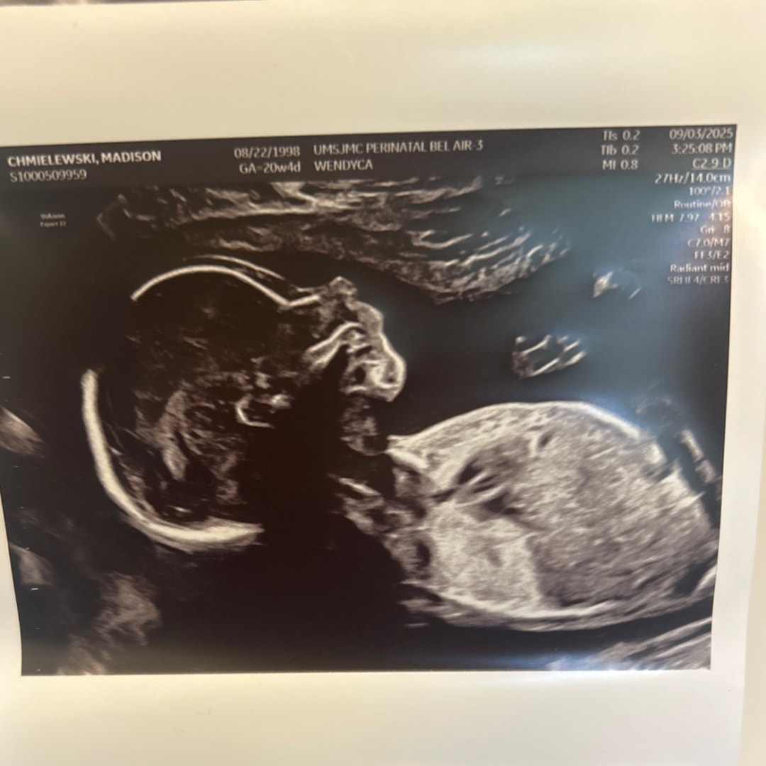 Photo shared by Madison for their Babylist baby registry.