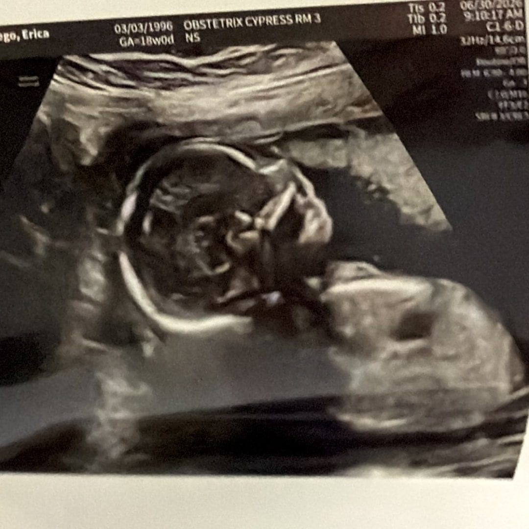 Photo shared by Erica for their Babylist baby registry.
