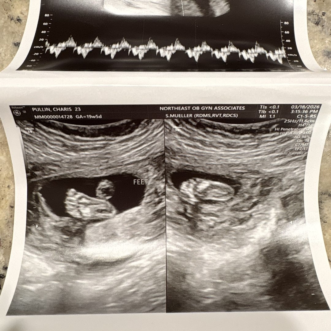 Photo shared by Charis for their Babylist baby registry.