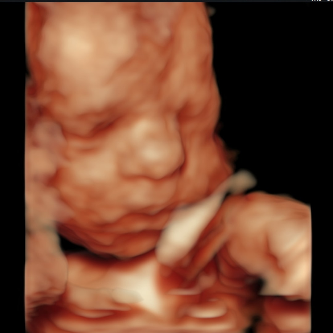 Photo shared by Dearbhla for their Babylist baby registry.