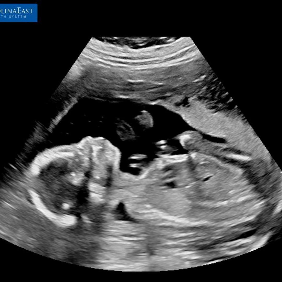 Photo shared by Ariel for their Babylist baby registry.