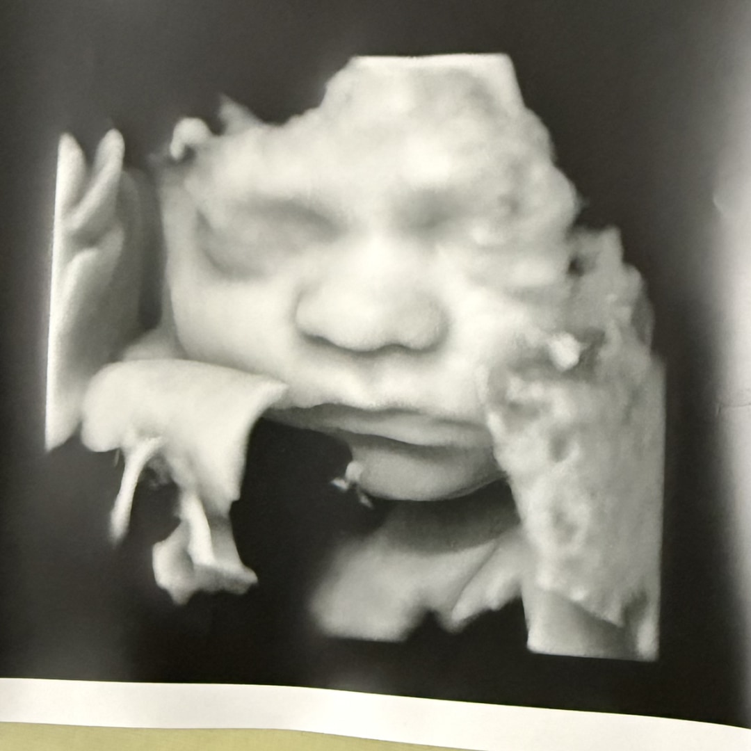 Photo shared by Ashlee for their Babylist baby registry.