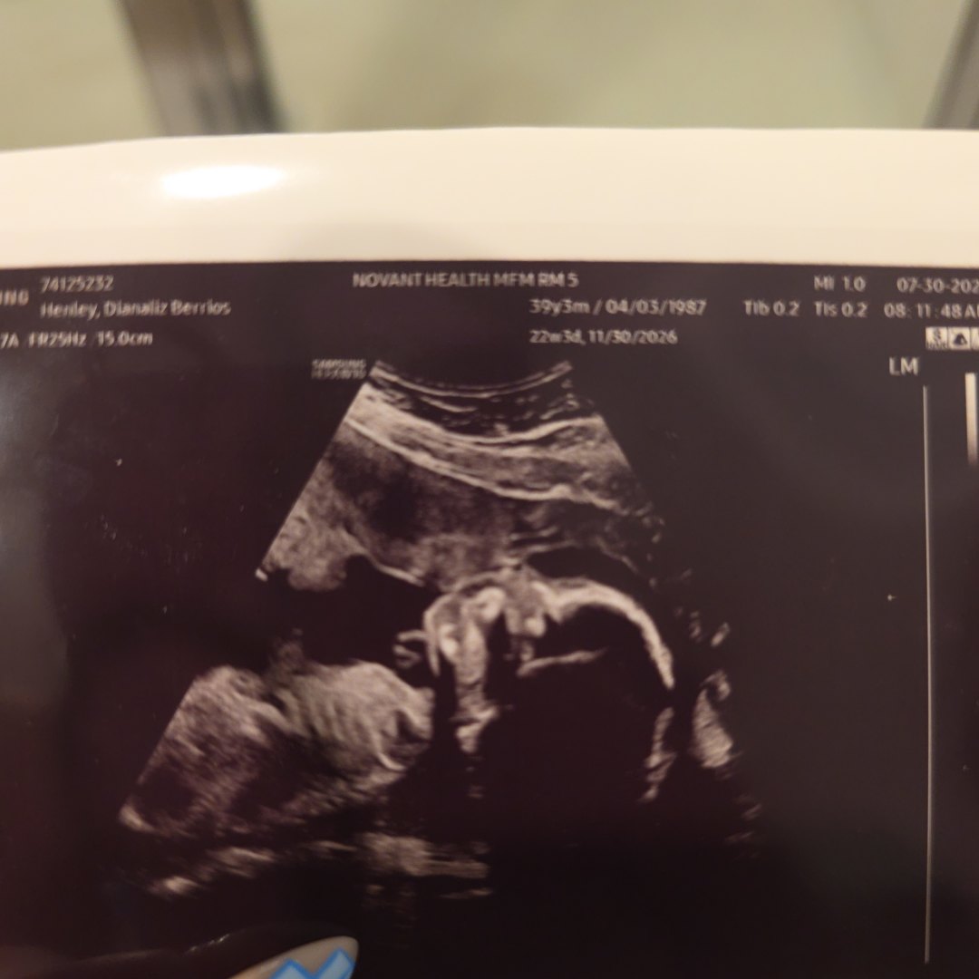 Photo shared by Dianaliz for their Babylist baby registry.