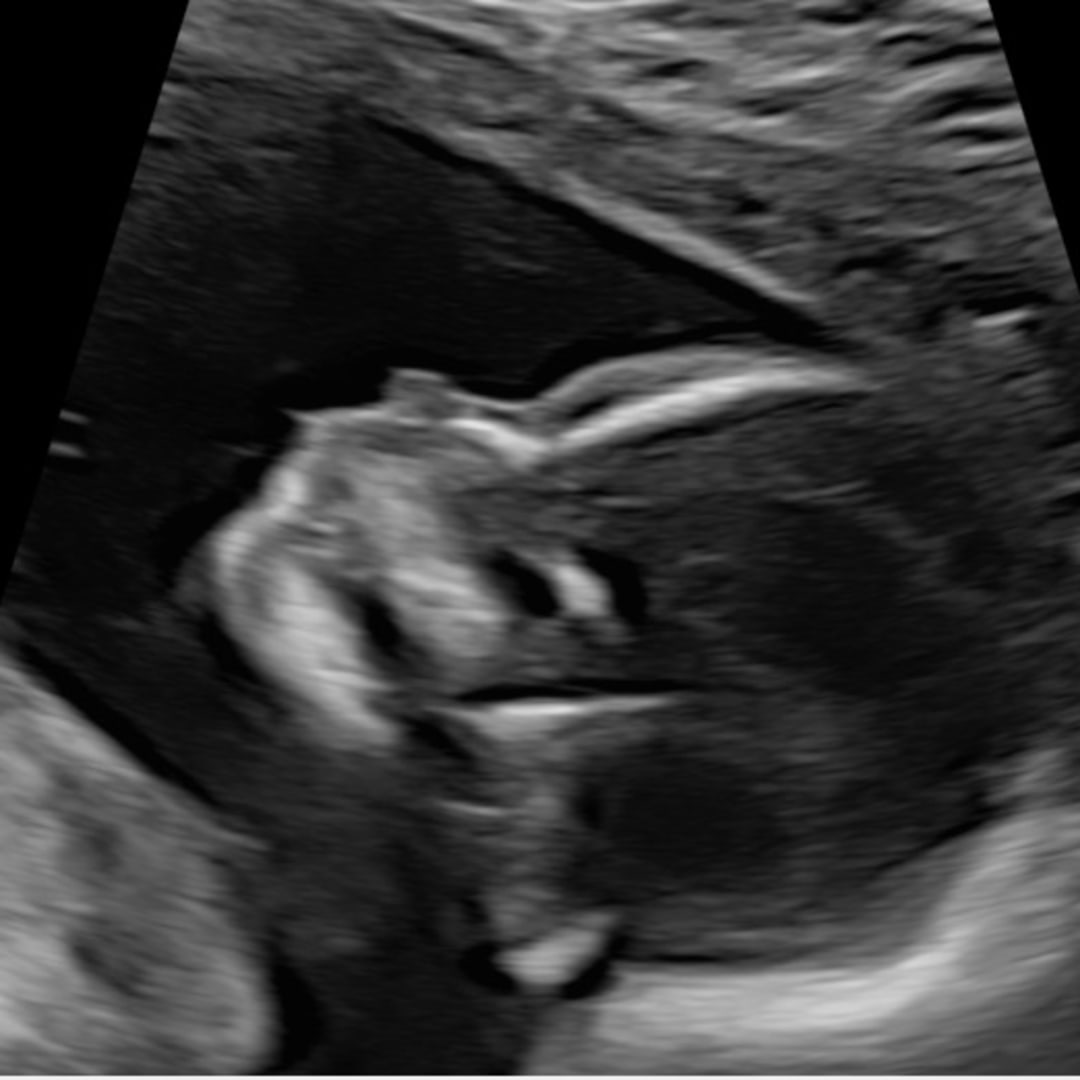 Photo shared by Ana for their Babylist baby registry.