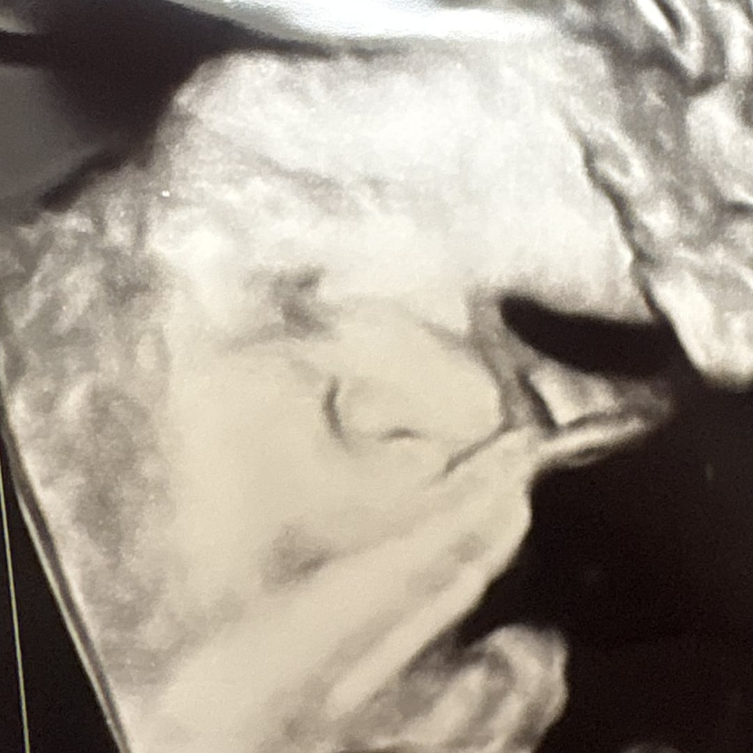 Photo shared by Zowie for their Babylist baby registry.