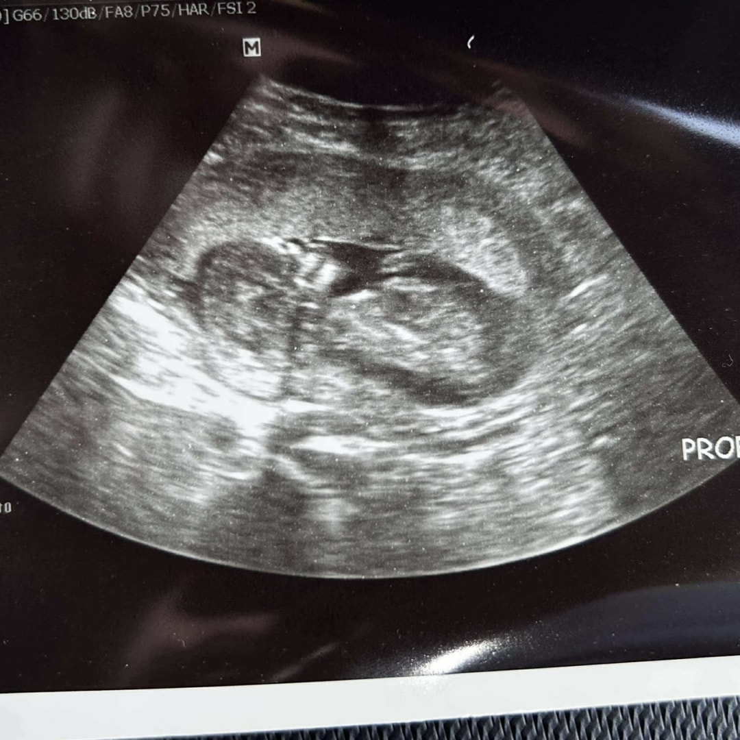 Photo shared by Amber for their Babylist baby registry.