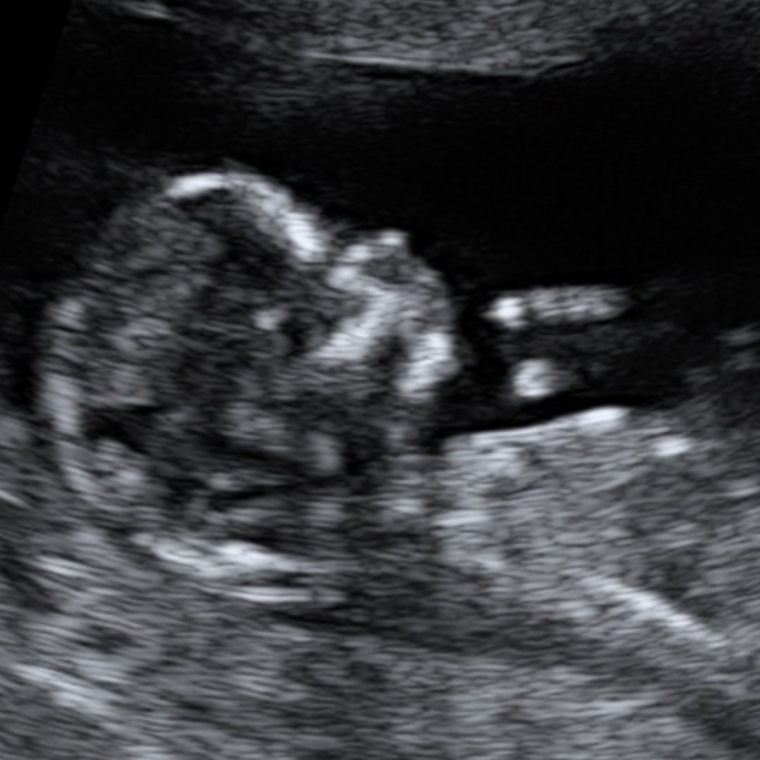 Photo shared by Gabriella for their Babylist baby registry.