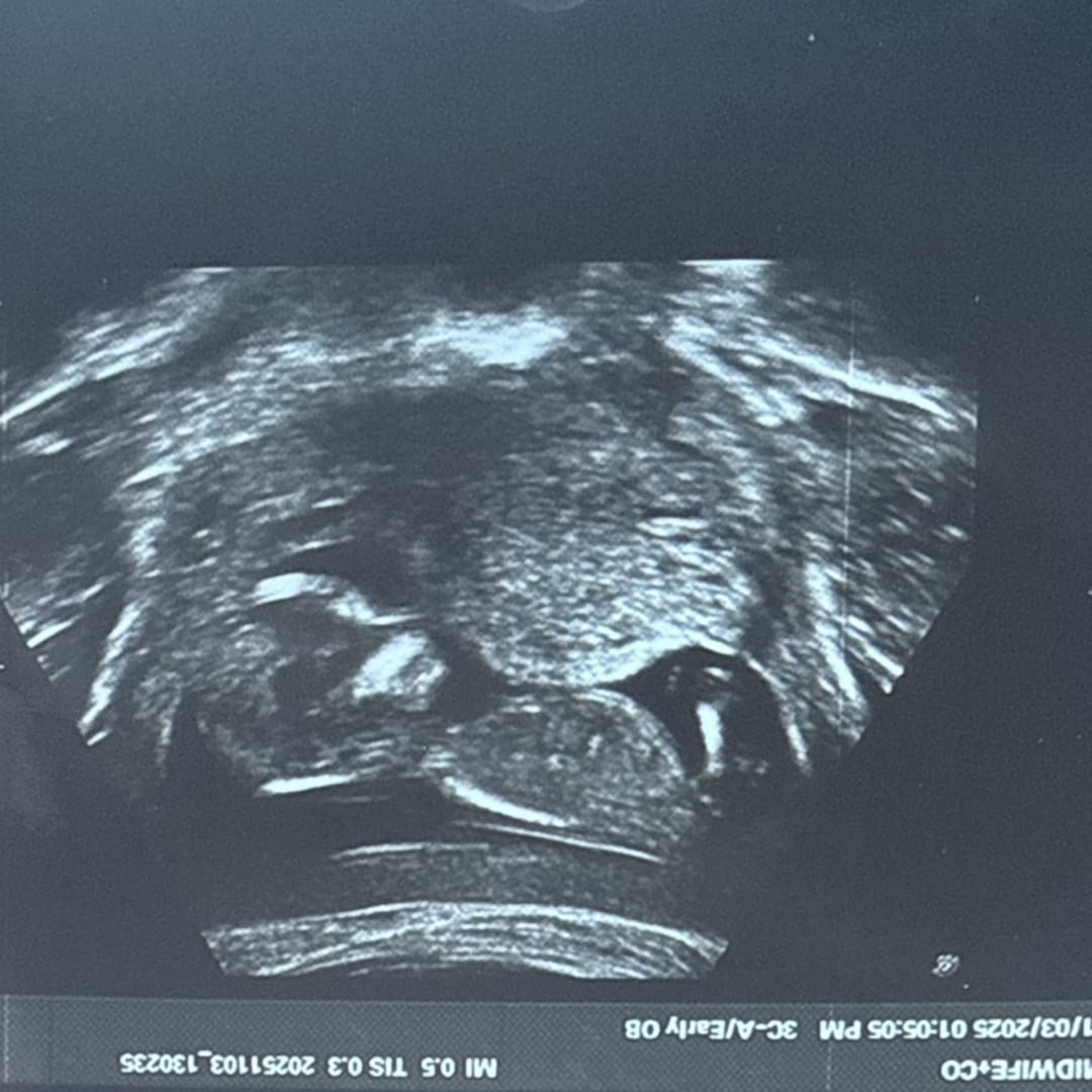 Photo shared by Mariah for their Babylist baby registry.