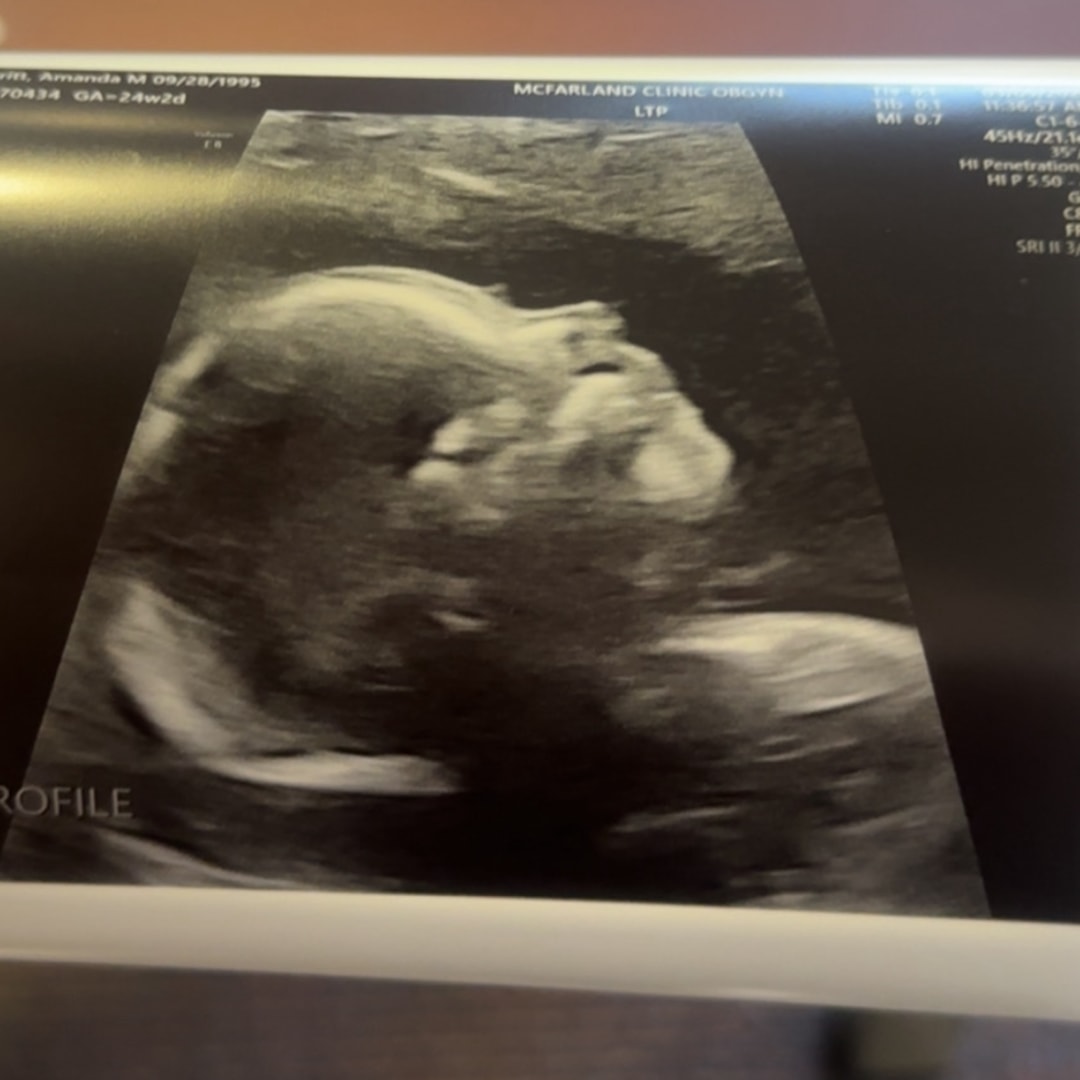 Photo shared by Amanda for their Babylist baby registry.