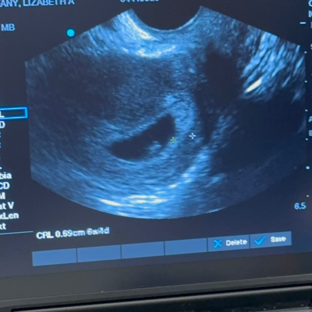 Photo shared by Liz for their Babylist baby registry.