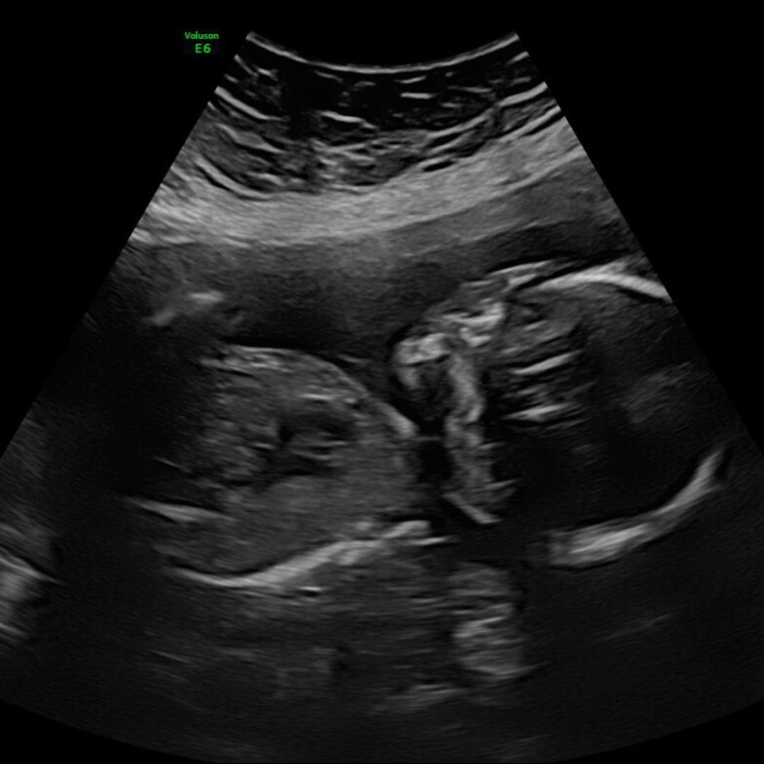 Photo shared by Bethany for their Babylist baby registry.