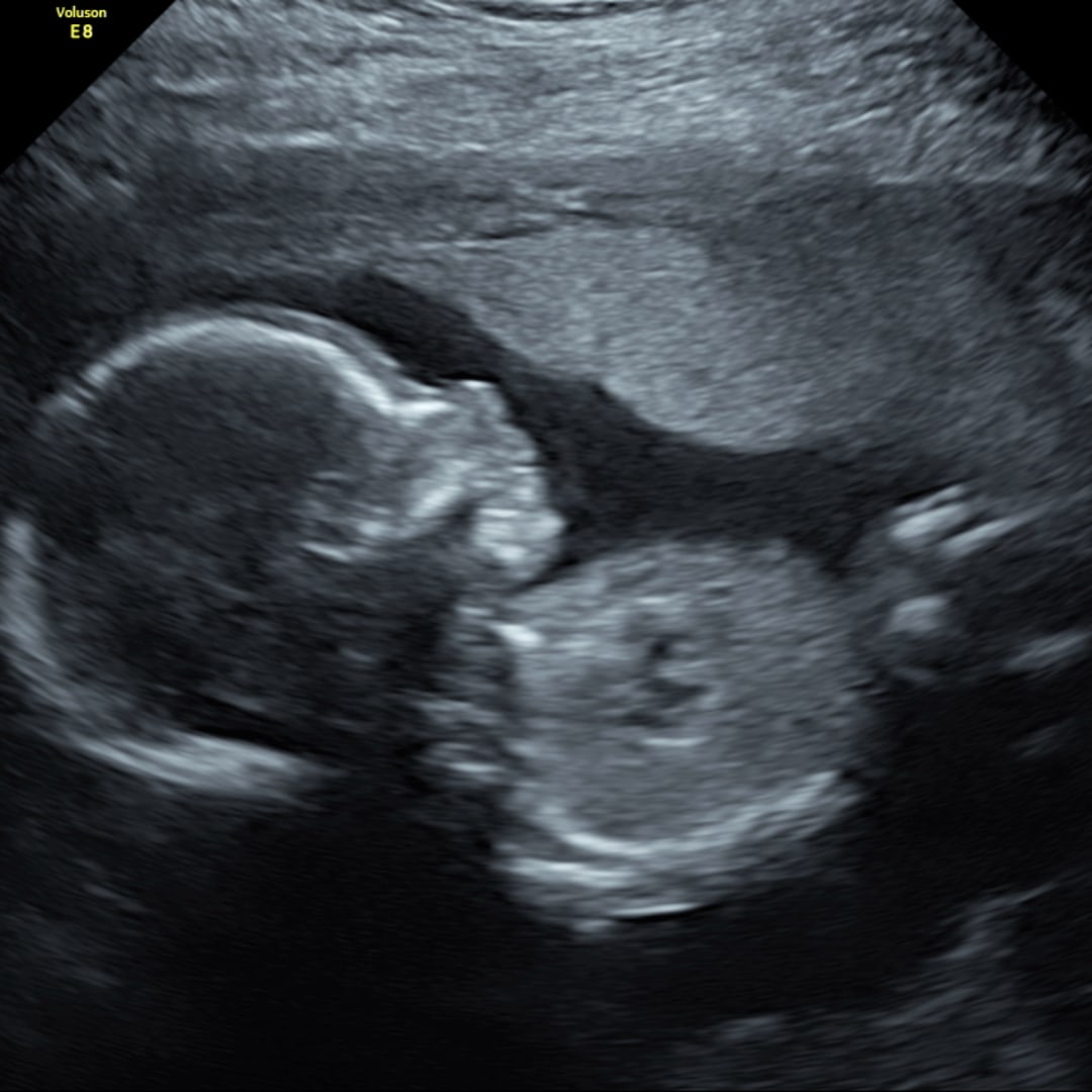 Photo shared by Miranda for their Babylist baby registry.