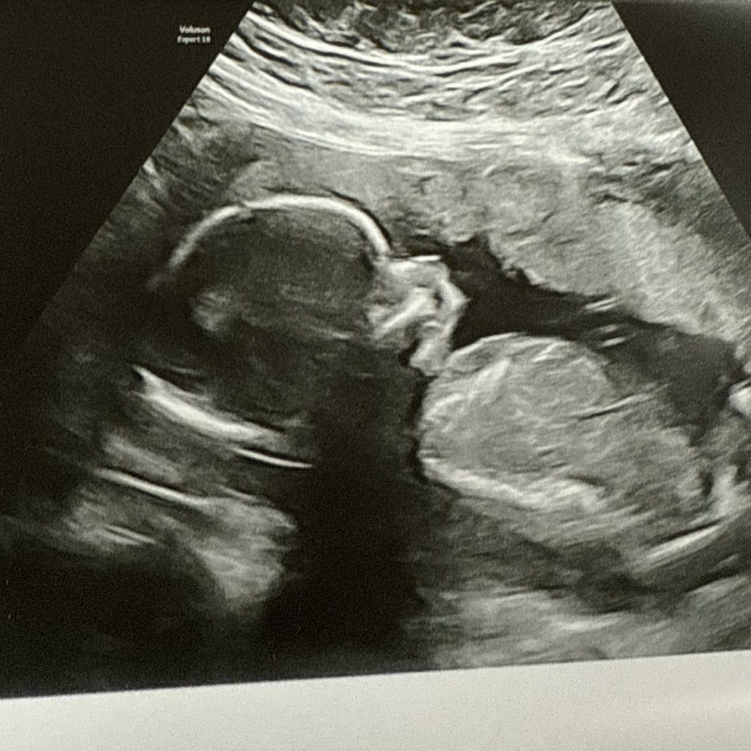 Photo shared by Kimberly for their Babylist baby registry.