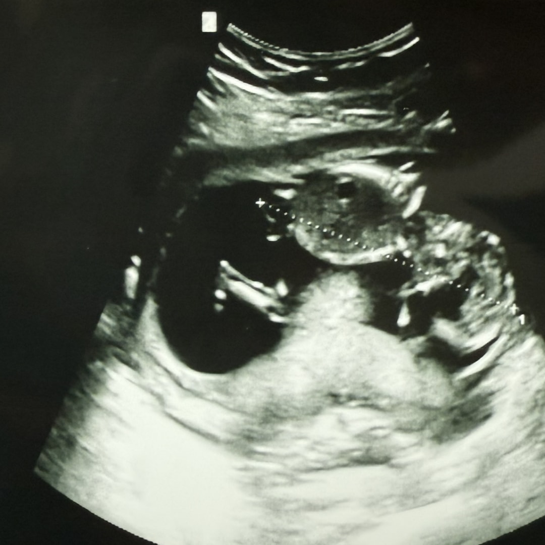 Photo shared by Meri for their Babylist baby registry.