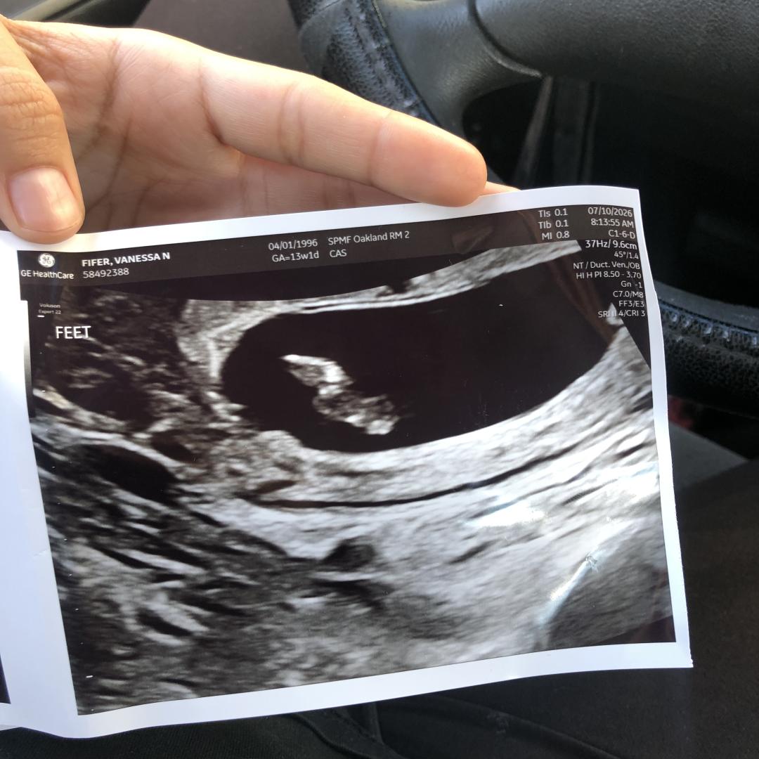 Photo shared by Vanessa for their Babylist baby registry.