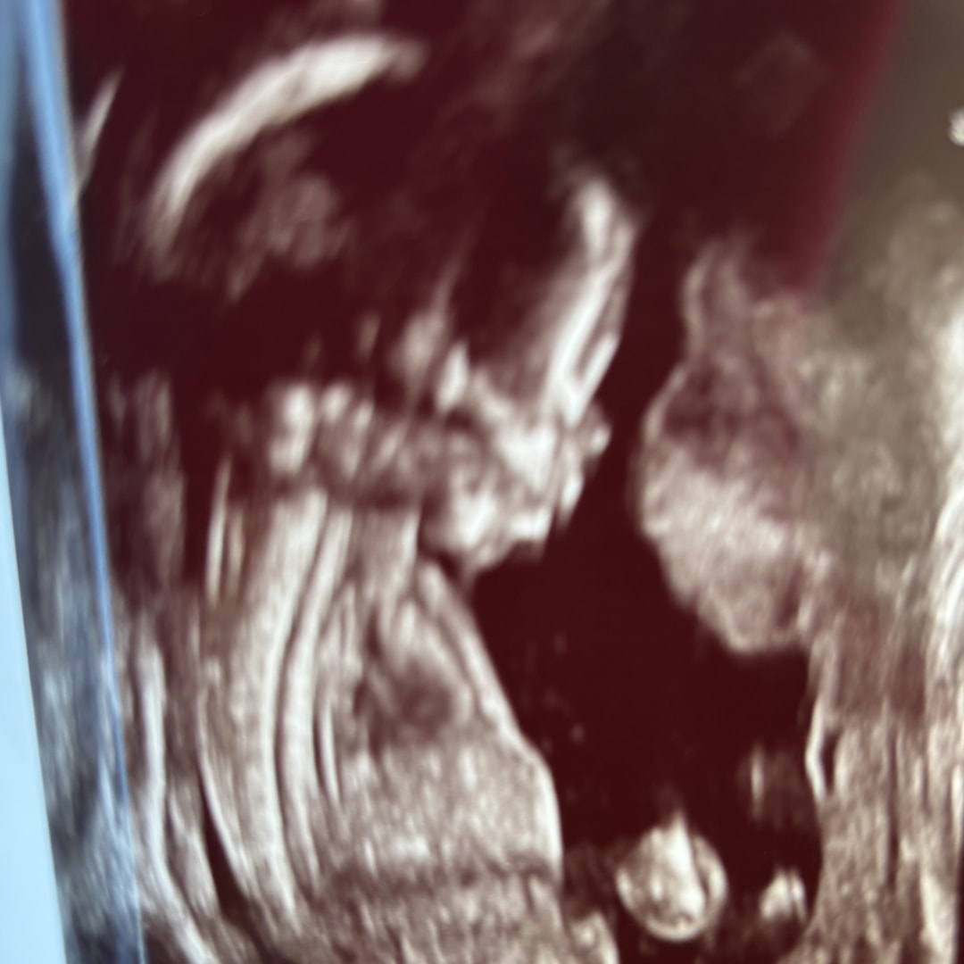 Photo shared by Kennedy for their Babylist baby registry.