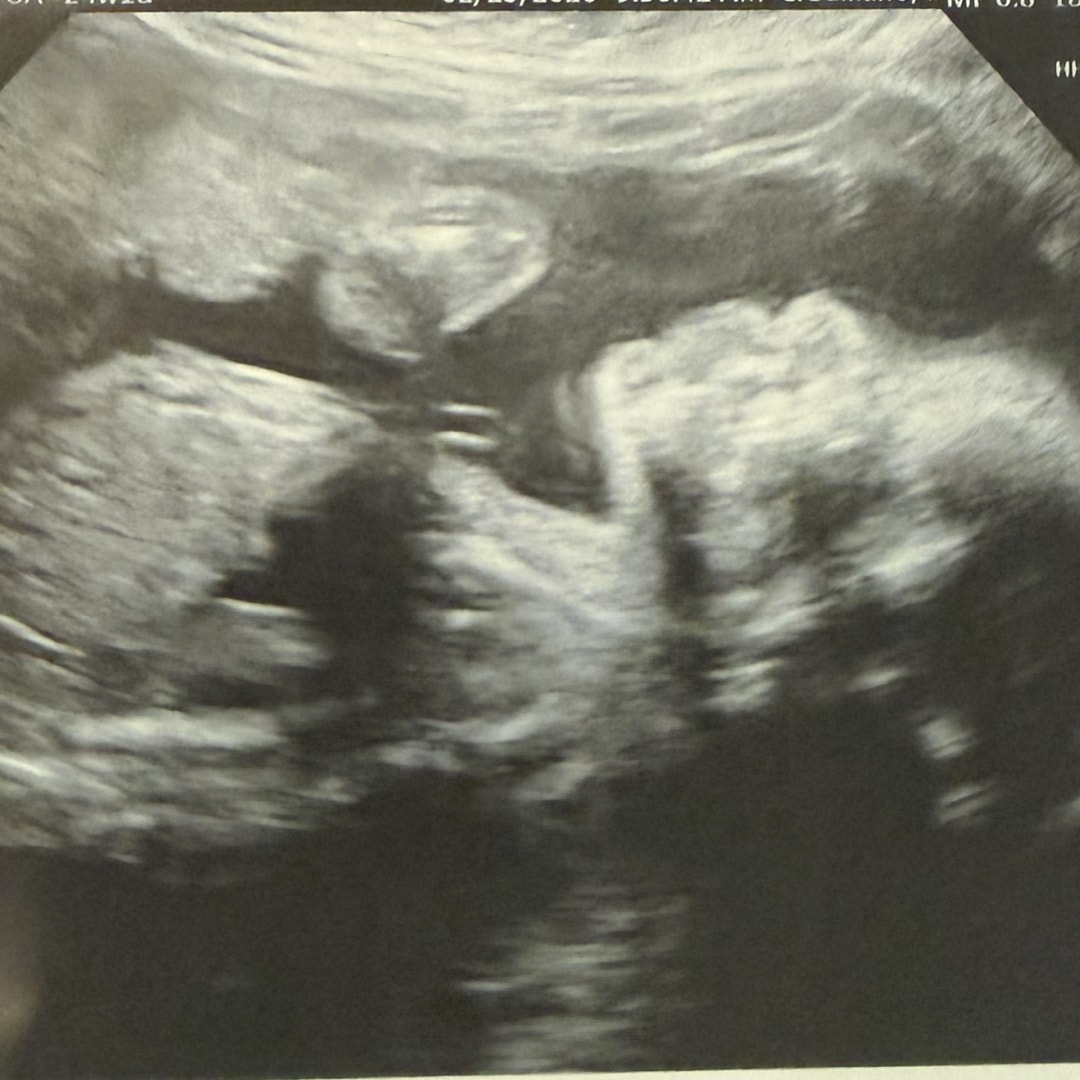 Photo shared by Miriam for their Babylist baby registry.