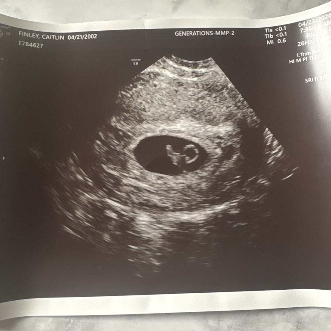 Photo shared by Caitlin for their Babylist baby registry.