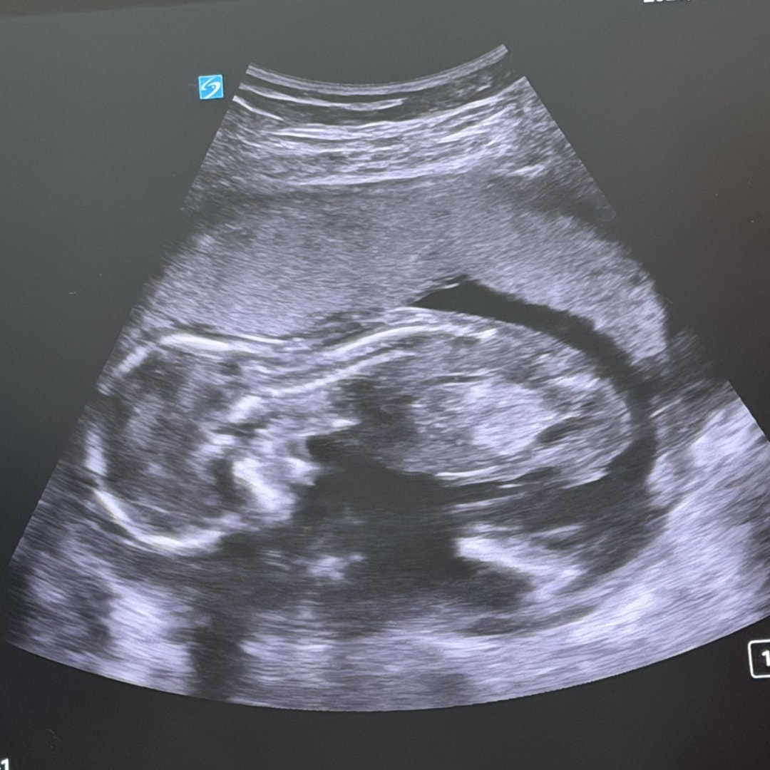 Photo shared by Amber for their Babylist baby registry.