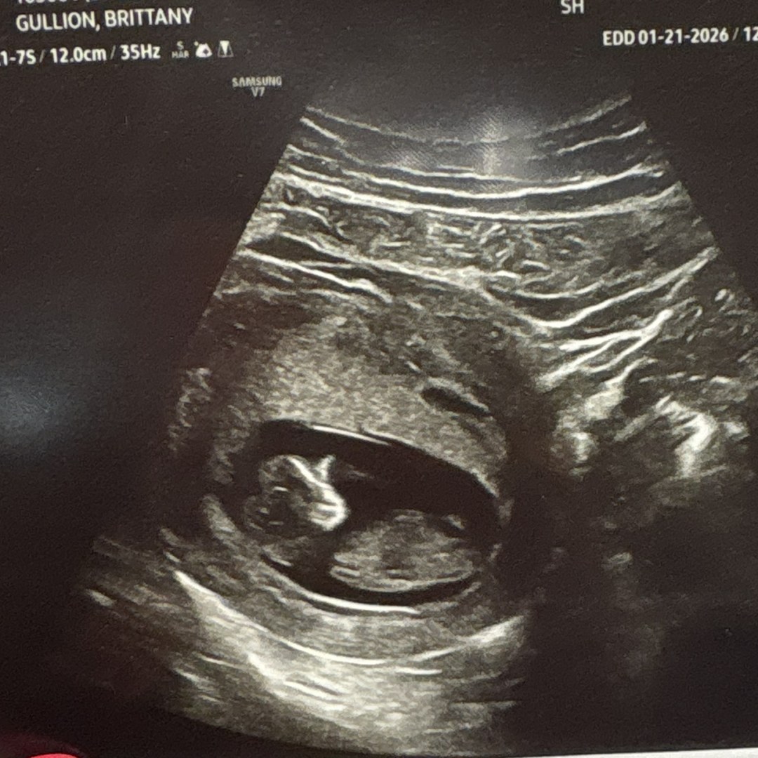 Photo shared by Brittany for their Babylist baby registry.
