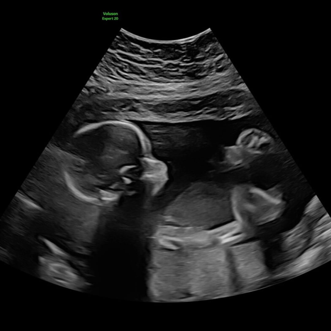 Photo shared by Erin for their Babylist baby registry.
