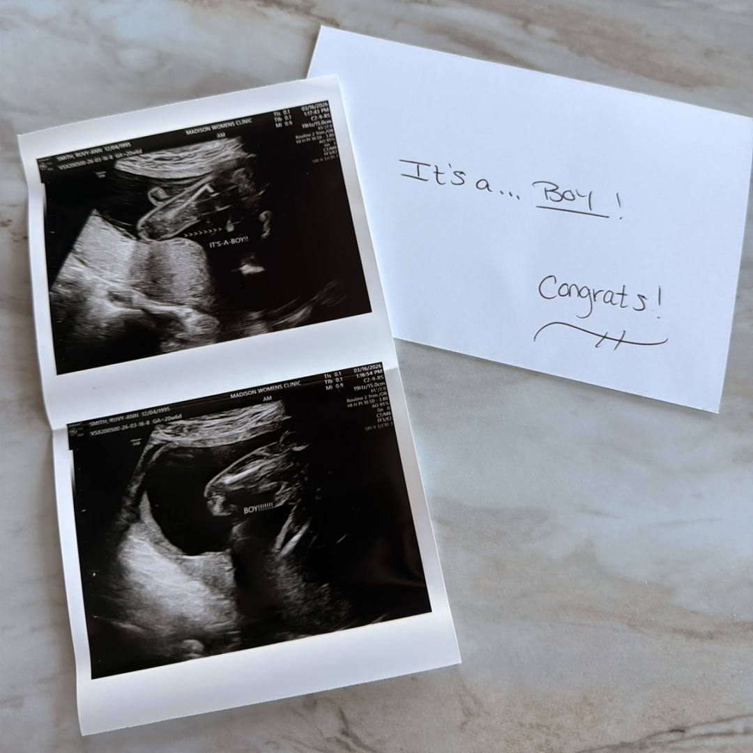 Photo shared by Ruvy Ann for their Babylist baby registry.