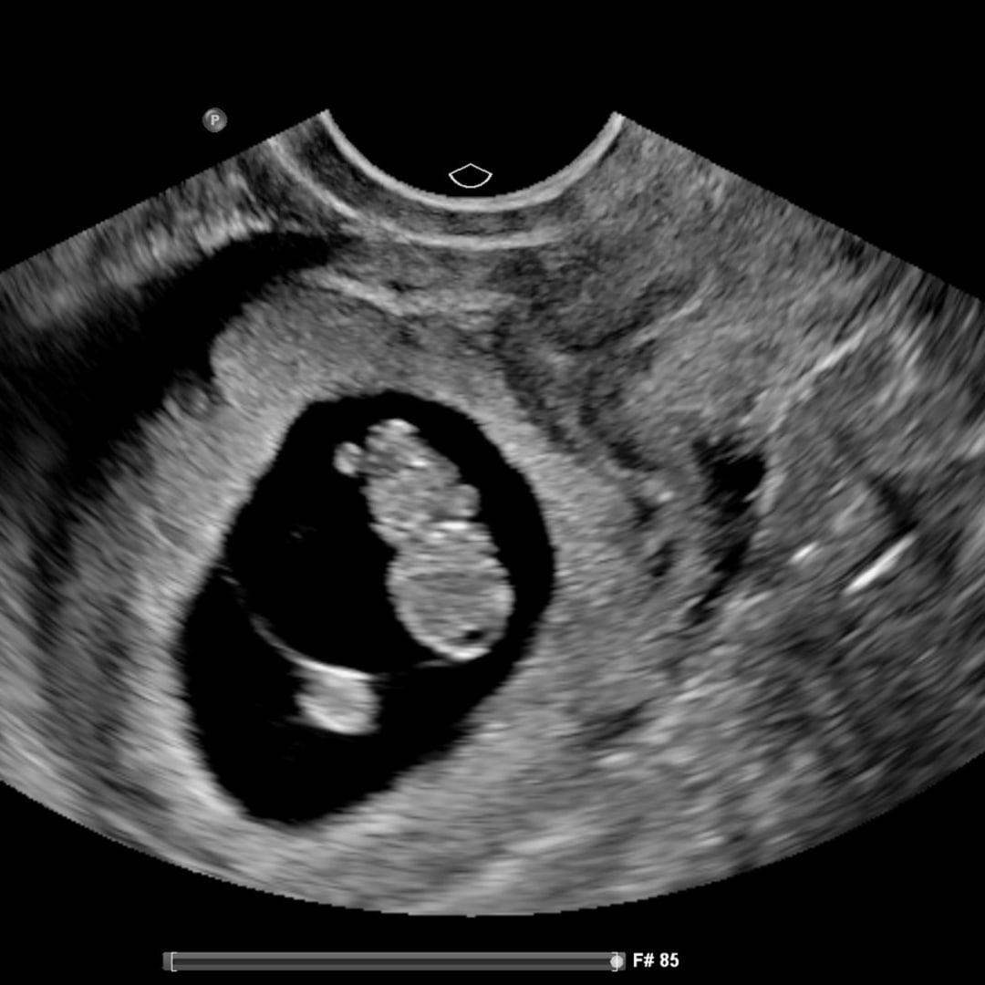 Photo shared by Ellie for their Babylist baby registry.