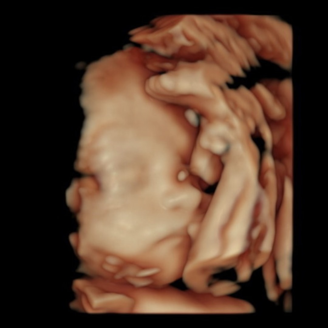 Photo shared by Christina for their Babylist baby registry.