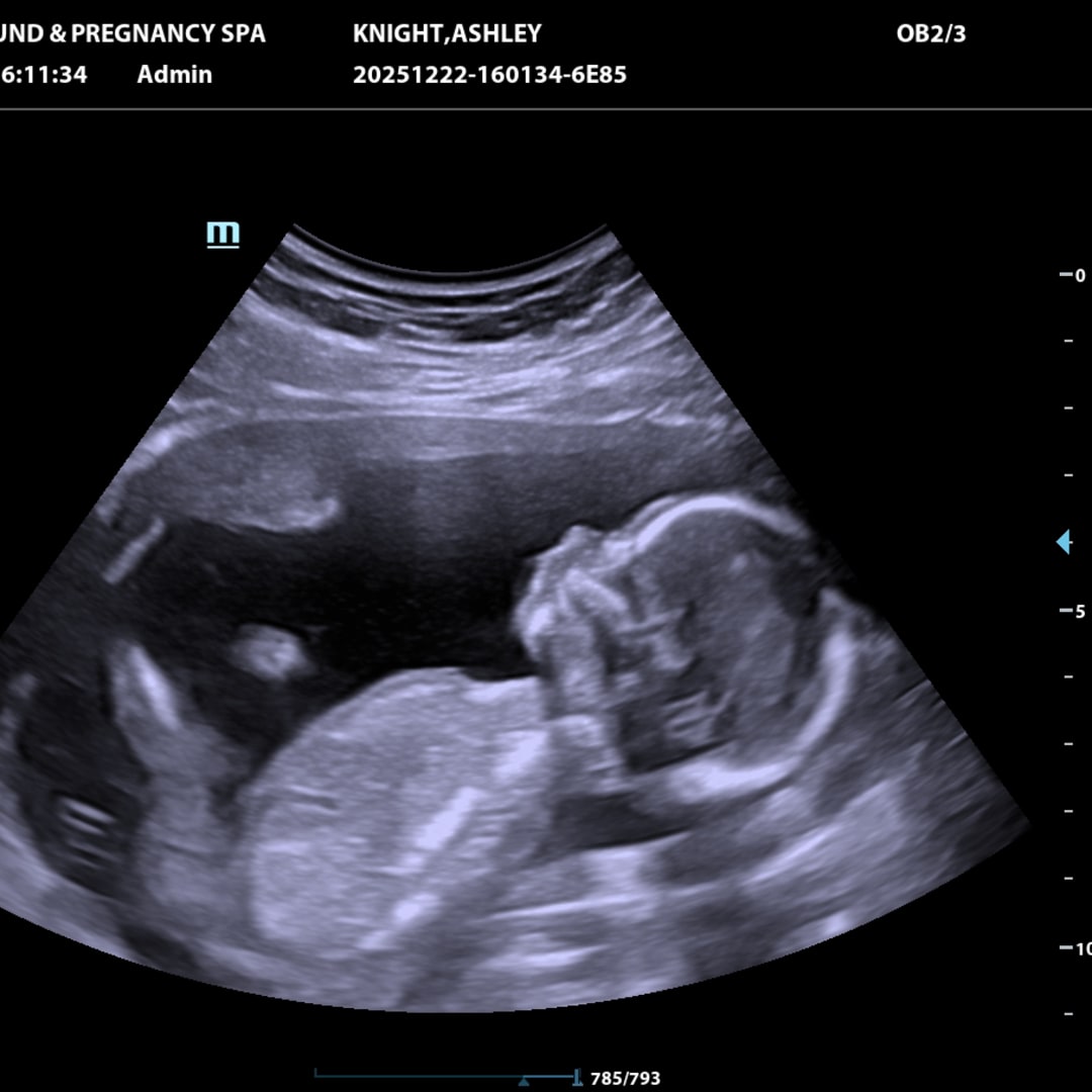 Photo shared by Ashley for their Babylist baby registry.