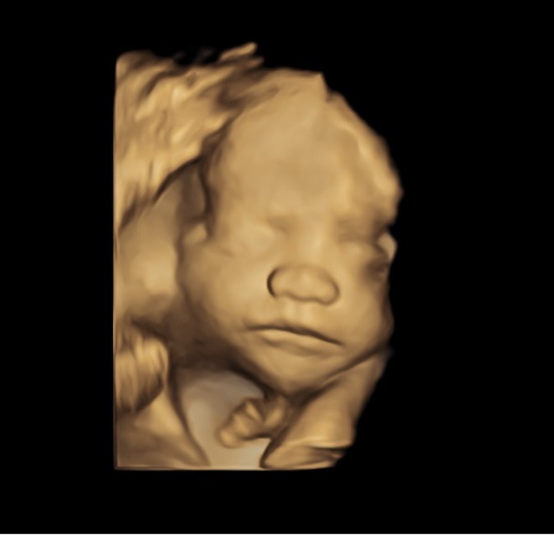 Photo shared by Destiny for their Babylist baby registry.