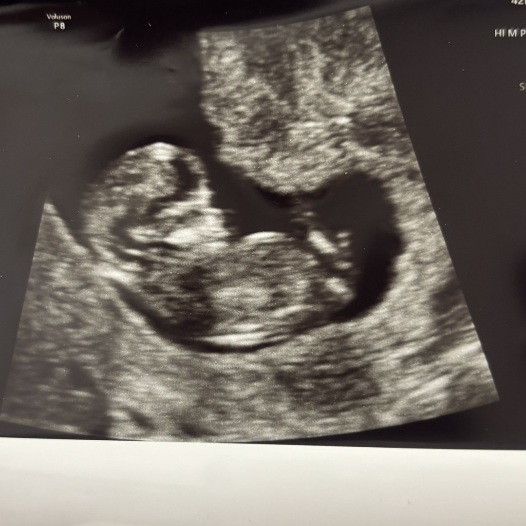 Photo shared by Emily for their Babylist baby registry.