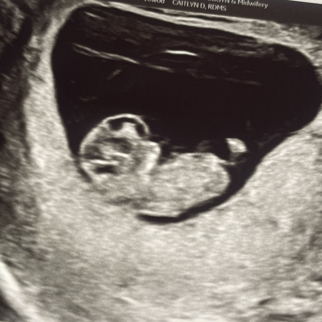 Photo shared by Natalie for their Babylist baby registry.