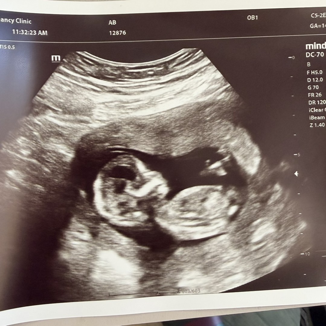 Photo shared by Angelicas for their Babylist baby registry.